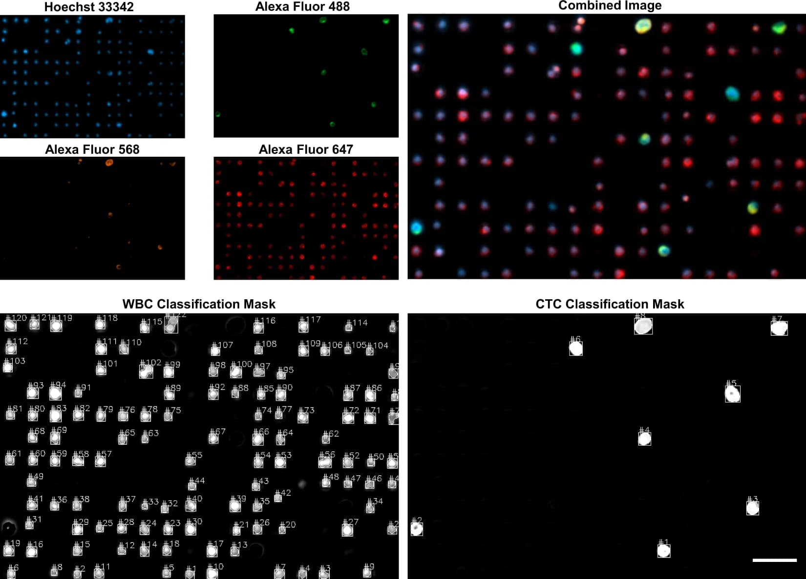 Fluorescence channel composite — Hoechst, Alexa Fluor 488/568/647, WBC and CTC classification masks